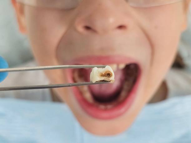 Best Emergency Pediatric Dental Care in Jordan, MN